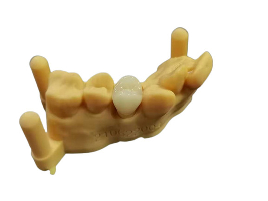 OEM 3D 인쇄하는 유연 아크릴릭 틀니 치아 실험실 디지털 설계