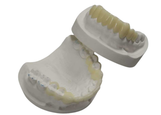 높은 내구성 CAD CAM 3D 인쇄 임시 크라운 튼튼한 수지
