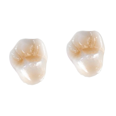 전도재 FDA 3014652903 산화 지르코늄 치아관 베니어판 인레이 온레이