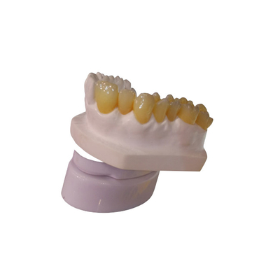 CAD 캠 설계 PFM 치아관 시험소 3D 프린터 치아관