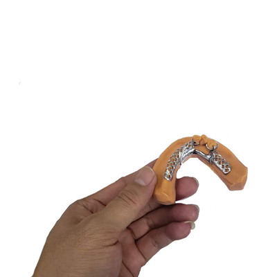 치과 의술의 3D 인쇄하는 제거할 수 있는 치아관 구조 모델들
