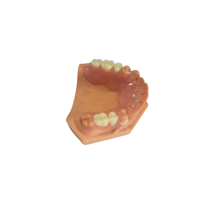 디지털 데이터를 기반으로 하는 치아 실험실을 위한 3D 인쇄된 틀니
