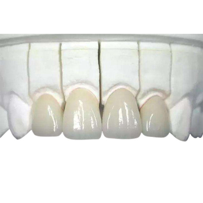 대단히 생체조직이나 기관과 잘 교합할 수 있는 3D 인쇄된 산화 지르코늄 치아관 마모 저항자