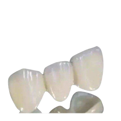 치과용 실험실 산화 지르코늄 의치 높은 견고성 CAD 캠 기술