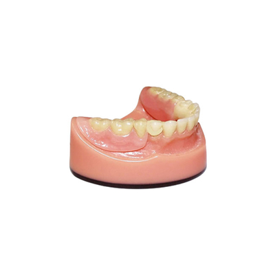 OEM PFM 치아 브리지 3D 디지털 구강 내 주사 이미징 시스템