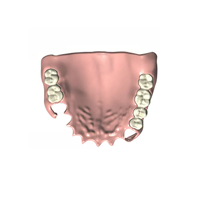 높은 씹기 효율 틀니 치아 실험실 CAD / 캠 고정 부분의치