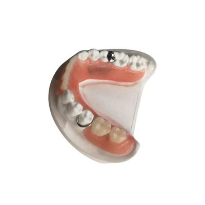 3D 인쇄된 산화 지르코늄 치아관 품질 보증 관습은 제거가능한 의치를 만들었습니다
