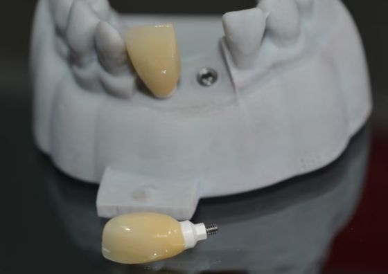 CAD PEEK 맞춤형 기둥