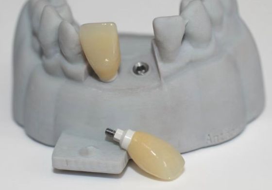 CAD PEEK 맞춤형 기둥