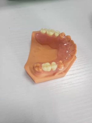 디지털 데이터를 기반으로 하는 치아 실험실을 위한 3D 인쇄된 틀니