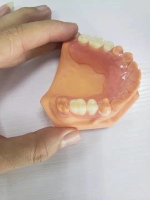 디지털 데이터를 기반으로 하는 치아 실험실을 위한 3D 인쇄된 틀니