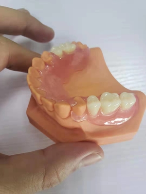 디지털 데이터를 기반으로 하는 치아 실험실을 위한 3D 인쇄된 틀니