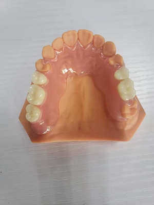 디지털 데이터를 기반으로 하는 치아 실험실을 위한 3D 인쇄된 틀니