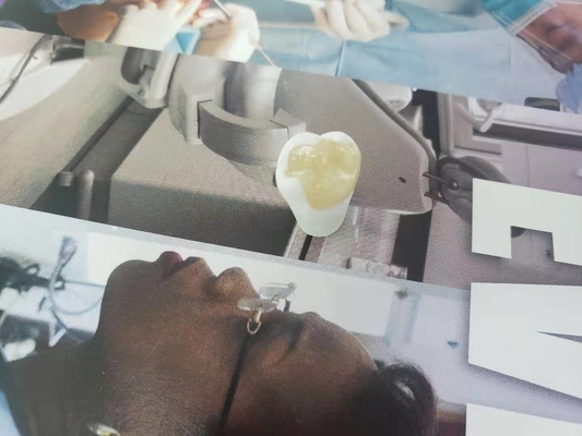 비슷한 오래가는 FDA 전도재 치아관 베니어판 인레이 온레이