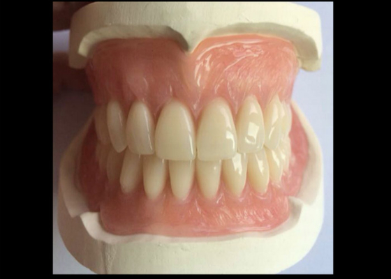 CAD-CAM 충돌 3D 인쇄된 크라운은 유지하고 적합하기 쉽습니다