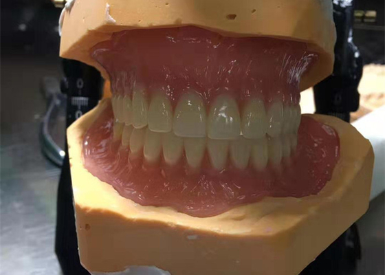 CAD-CAM 충돌 3D 인쇄된 크라운은 유지하고 적합하기 쉽습니다