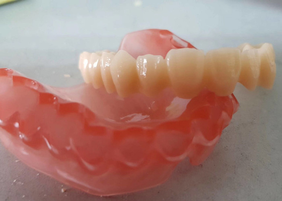 치과 연구의 현실적 디지털 데이터 OEM 인쇄된 치아의 모델들 3D명