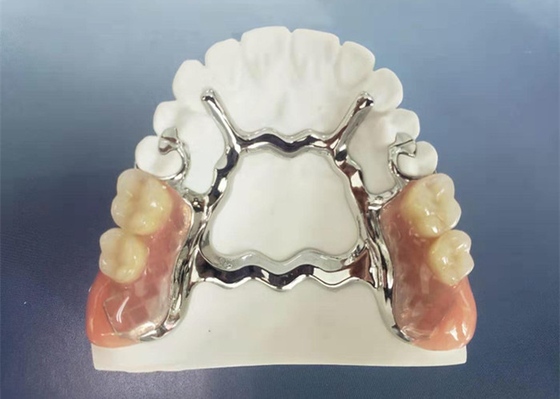 냇루랄은 치과의사 연구를 위한 3D 프린팅 고정된 제거가능한 의치를 그늘지게 합니다
