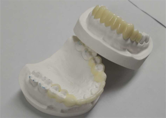 높은 내구성 CAD CAM 3D 인쇄 임시 크라운 튼튼한 수지