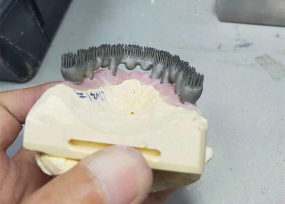 연구를 위한 오래가는 CAD 캠 PFM 3D 프린터 치아 실험실 프린트
