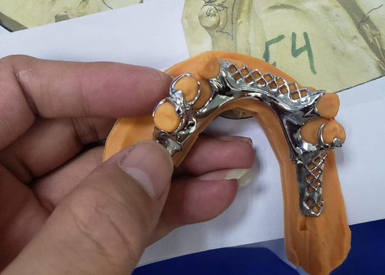 치과 의술의 3D 인쇄하는 제거할 수 있는 치아관 구조 모델들