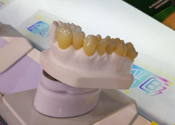 CAD 캠 설계 PFM 치아관 시험소 3D 프린터 치아관