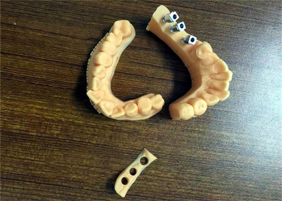 FDA 3D 인쇄된 치아의 모델들 치아관 자기는 금속으로 융합했습니다