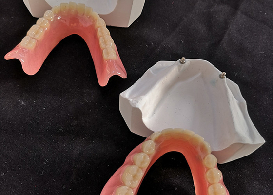 쉬운 편안한 CAD 캠 치과용 임플란트 중복 의치는 유지합니다