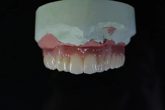 건강 안전 CAD 캠 치과용 임플란트 바 첨단 기술 생물학적인 소재