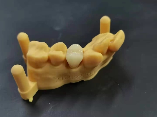 OEM 3D 인쇄하는 유연 아크릴릭 틀니 치아 실험실 디지털 설계