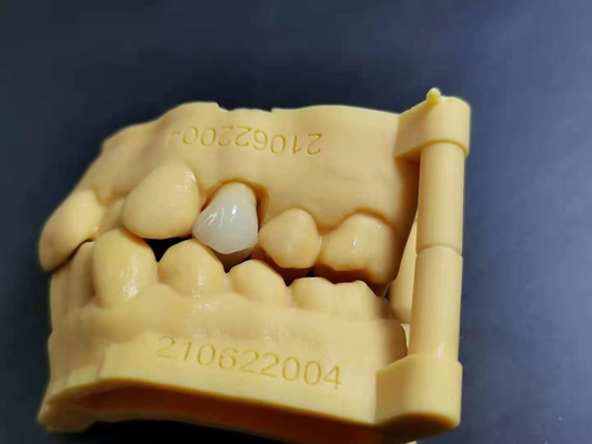 OEM 3D 인쇄하는 유연 아크릴릭 틀니 치아 실험실 디지털 설계