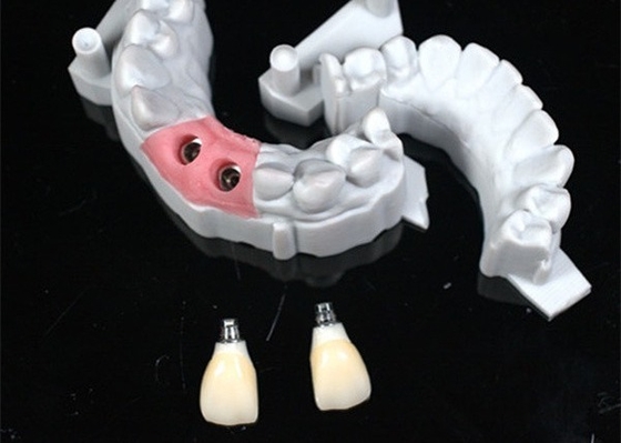 정밀 CAD/CAM 디자인