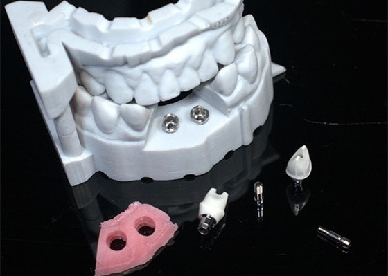 3D 모델 지르코니아 왕관