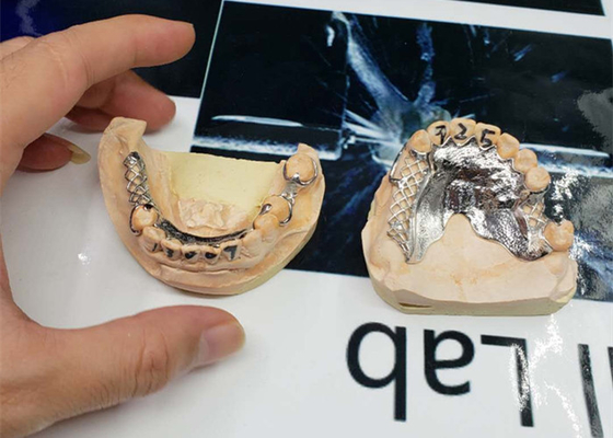 고정밀도 CAD-CAM 고정된 가동교의치 디지털화 설계