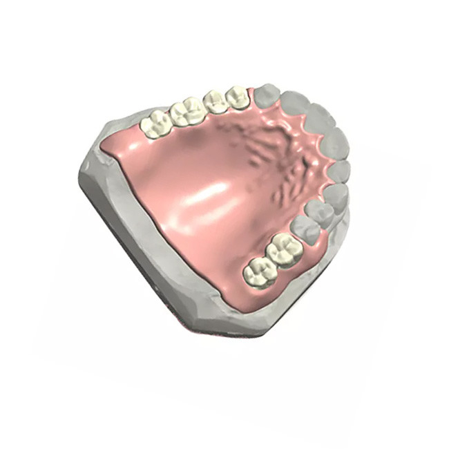 맞춤화된 제거할 수 있는 치아 국소 의치 자연색 치아의 모델 3D명