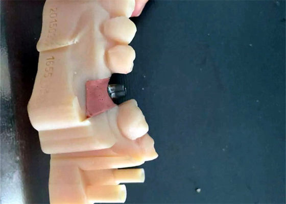 주문 fda pfm dental bridge, 양질 fda pfm dental bridge 제조 업체